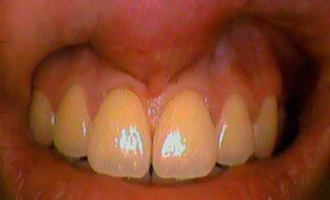 soaidental